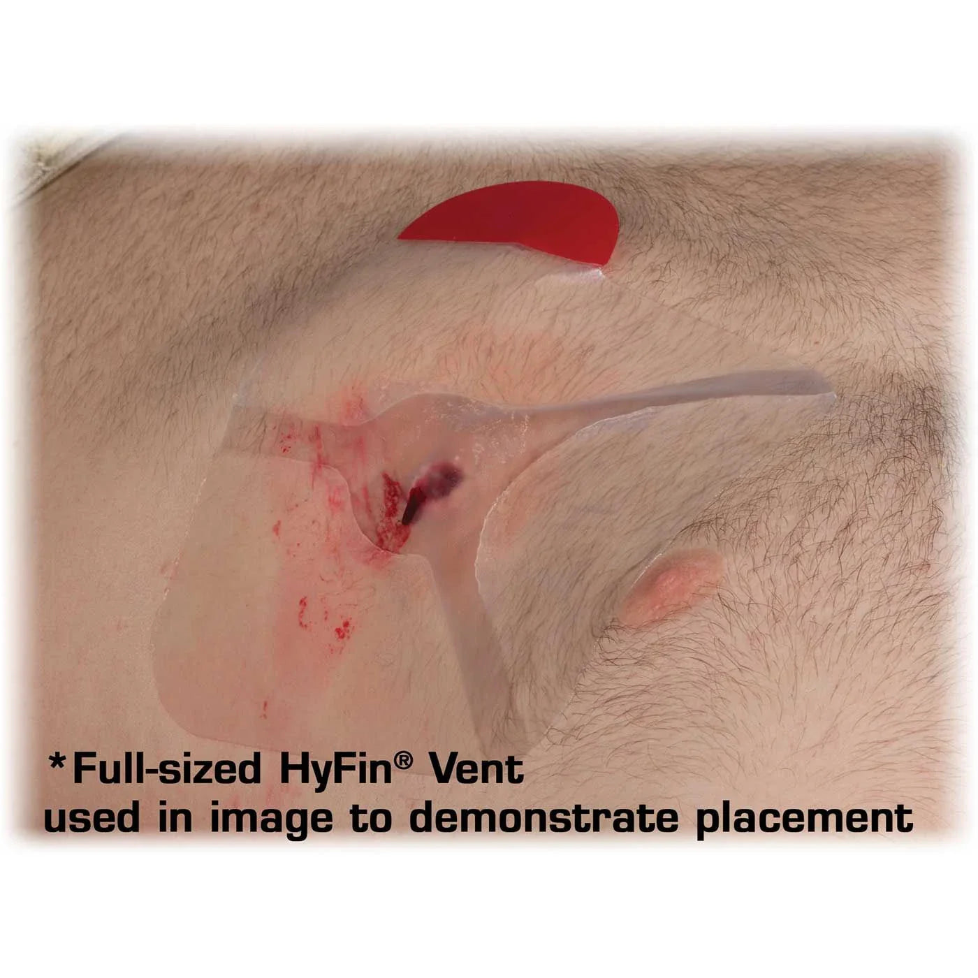 HyFin Vent Chest Seal Twin Pack – Trusted Chest Wound Care for Field Emergencies
